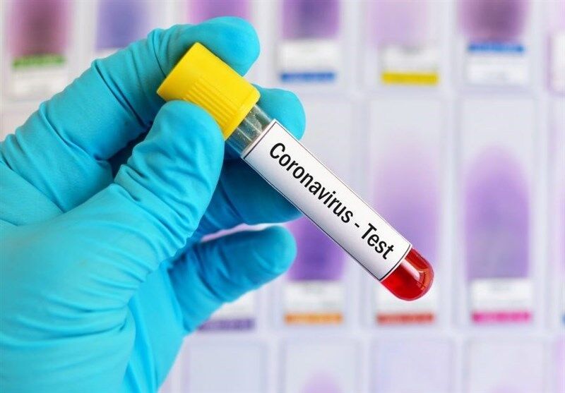 Koronavirus xəstələrindən götürülən testin həssaslığı 100 faiz deyil - Səhiyyə Nazirliyi 