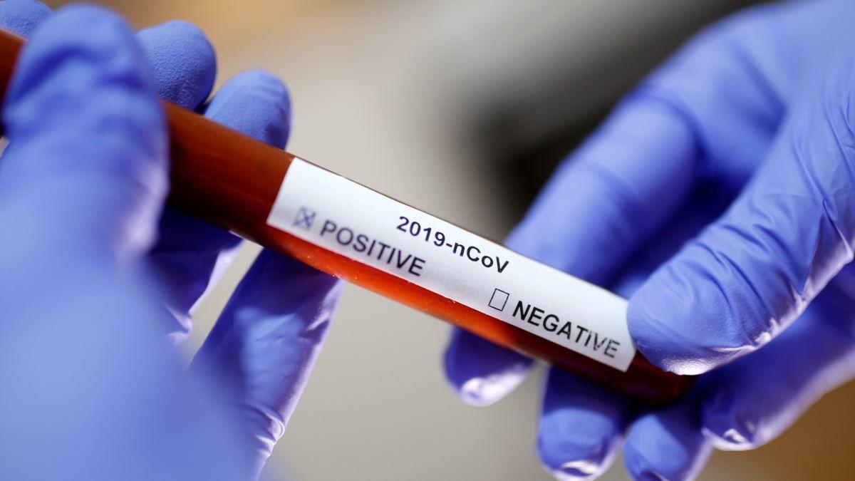 Meksikada koronavirusdan ölənlərin sayı 40 mini keçdi