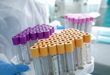 Oksford Universitetinin hazırladığı koronavirusa qarşı vaksin sınaqdan uğurla keçib