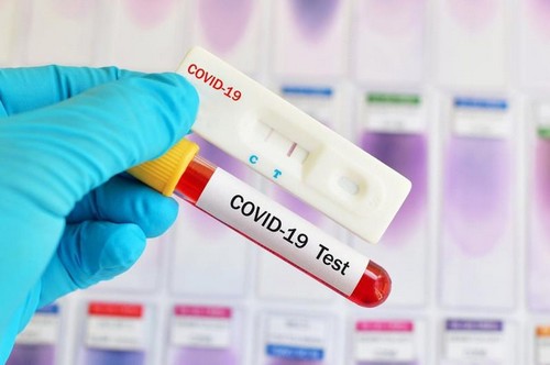 Koronavirusa görə aparılan gündəlik testlərin sayı 12-13 mini keçəcək - Baş Nazir açıqladı