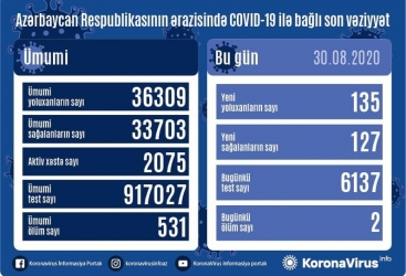 Azərbaycanda koronavirusa 135 yeni yoluxma faktı qeydə alınıb
