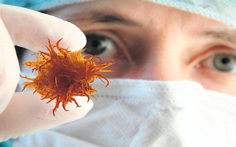 Xərçənglə mübarizə üsulu tapıldı