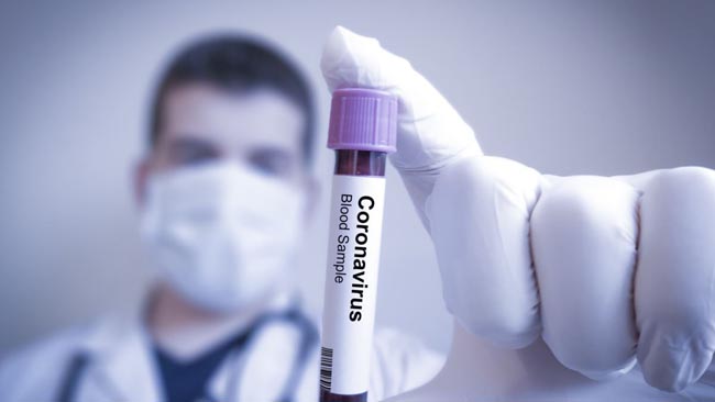 Rusiyada ikinci koronavirus vaksininin hazır olacağı vaxt açıqlanıb