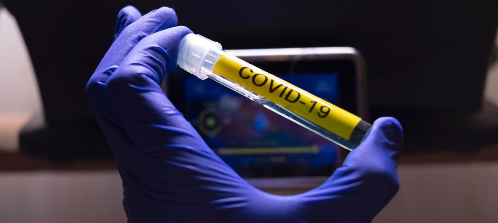 COVID-19-a qarşı vaksinə bərabər çıxış pandemiya ilə uğurlu mübarizənin əsas şərtidir