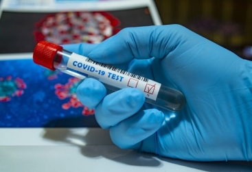 Ermənistanda koronavirusdan ölənlərin sayı 900 nəfərə çatır