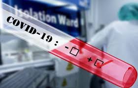 Ermənistanda koronavirusdan ölənlərin sayı 900-ü keçib