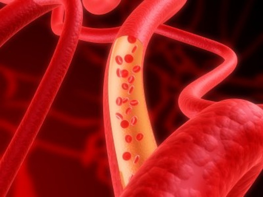 Yeni qan damarlarının müvəqqəti protezin üzərində inkişafına imkan verən matris hazırlanıb - Araşdırma