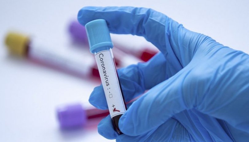 Çində son sutka ərzində 6 nəfərdə koronavirus aşkarlanıb