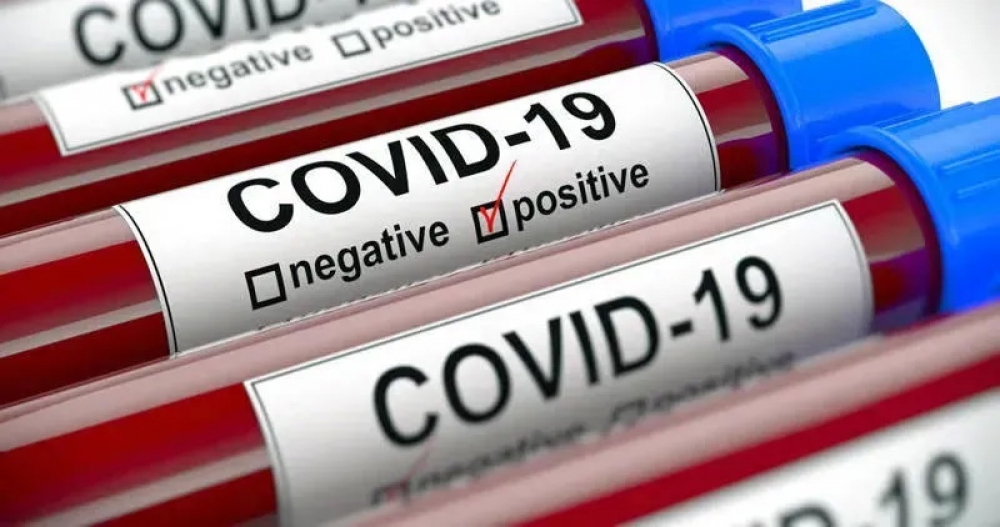 Britaniyada son sutkada koronavirusdan 137 nəfər ölüb