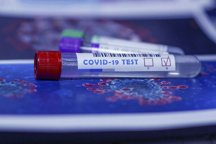 Azərbaycanda indiyədək 116 2062 koronavirus testi aparılıb  