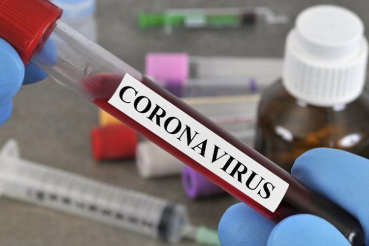 Gürcüstanda son sutkada 958 nəfər koronavirusa yoluxub
