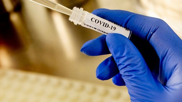 Ukraynada yeni ekspres koronavirus testləri istifadəyə veriləcək