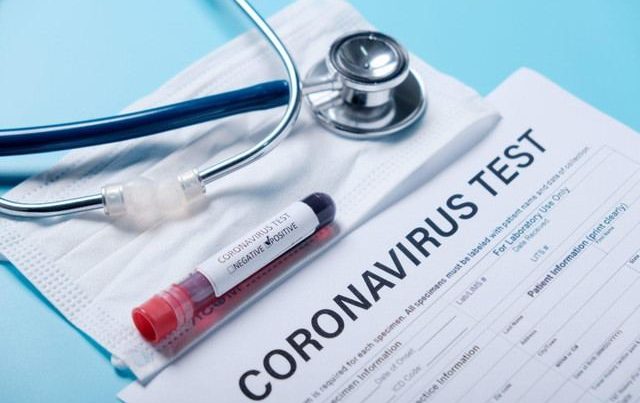 Azərbaycanda indiyədək 1250736 koronavirus testi aparılıb  