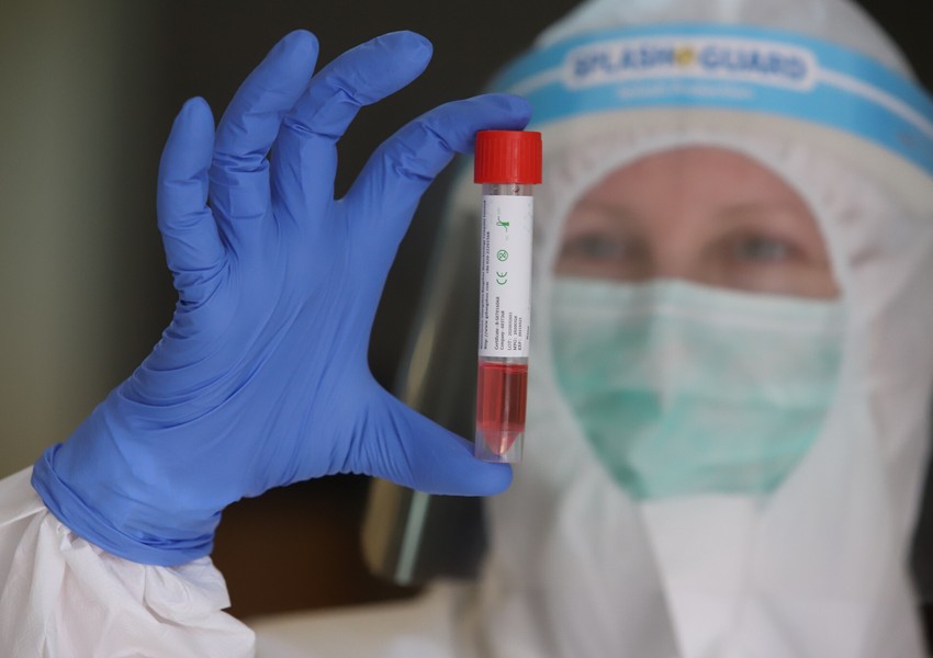 İsraildə koronavirusa yoluxanların sayı kəskin artdı  