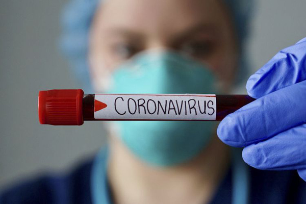 Rusiyada son sutkada koronavirusdan 442, Gürcüstanda 45, Ermənistanda isə 23 nəfər ölüb
