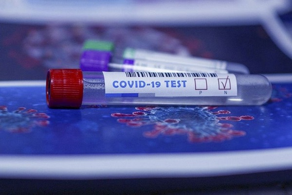 TƏBİB Azərbaycanda koronavirus testlərinin bitməsi barədə məlumatlara aydınlıq gətirib