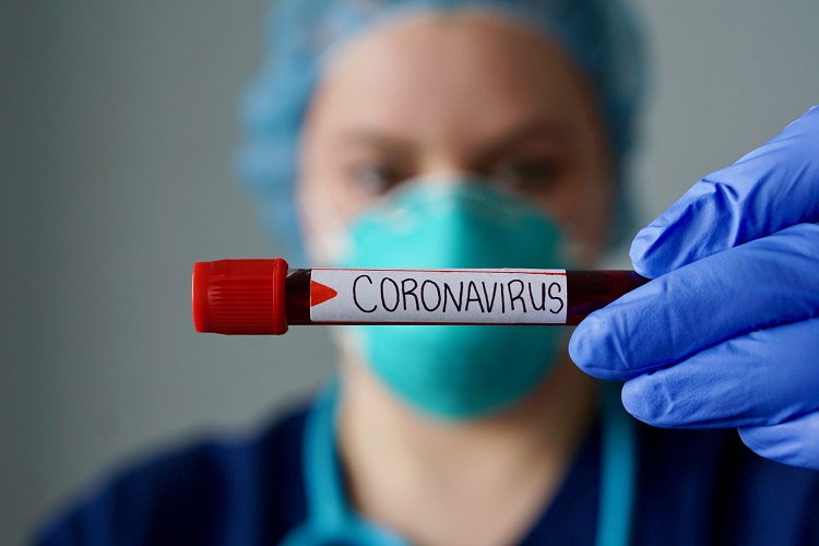 21 futbolçu və baş məşqçi koronavirusa yoluxdu