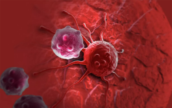 Rusiyalı onkoloq qidanı xərçəng xəstəliyinə çevirən əsas səhvi açıqlayıb