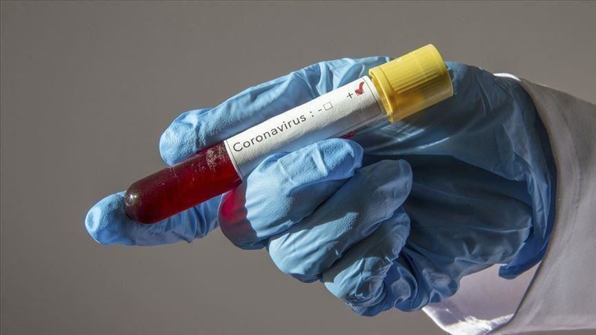 ÜST: Dünyada son sutkada 427 mindən çox insan koronavirusa yoluxub