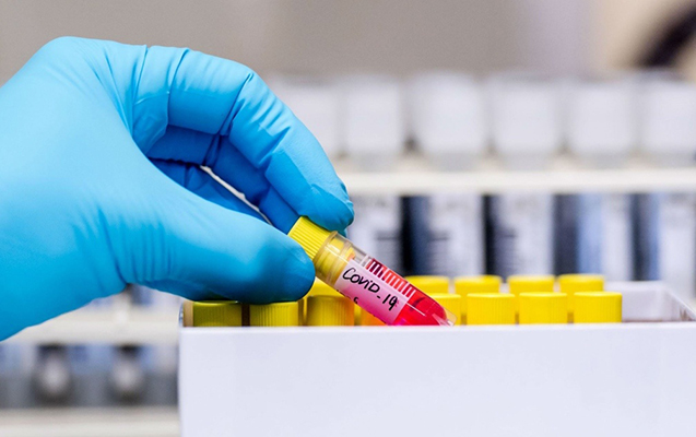 Azərbaycanda 15-dək deputat koronavirusa yoluxub