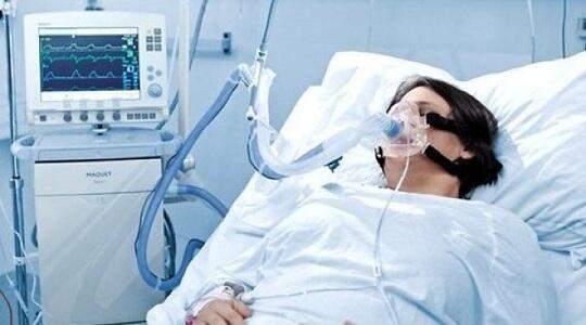 Süni tənəffüs aparatında olan koronaviruslu xəstələrin sayı açıqlanıb
