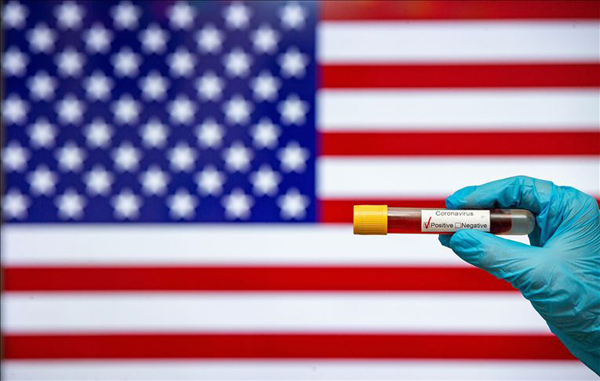 ABŞ-da bir gündə təqribən 143 min COVID-19-a yoluxma faktı qeydə alınıb