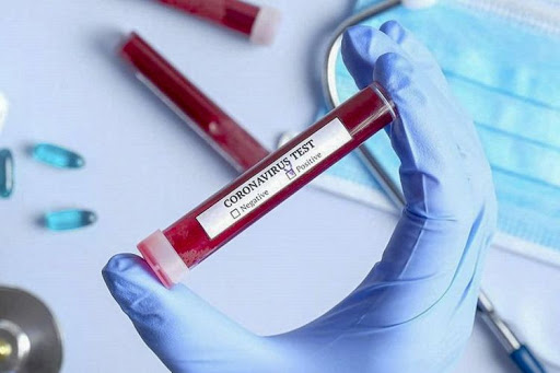 Azərbaycanda indiyədək 1 607 455 koronavirus testi aparılıb  