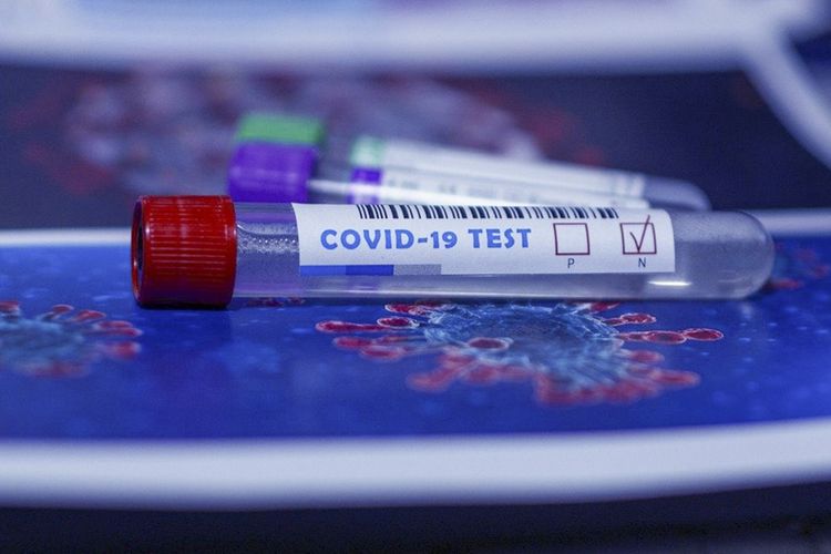 Azərbaycanda indiyədək 2031308 koronavirus testi aparılıb  