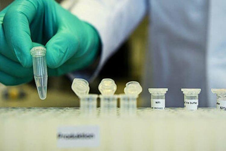 Çində ilk dəfə Böyük Britaniyada yayılan təhlükəli virus tapıldı