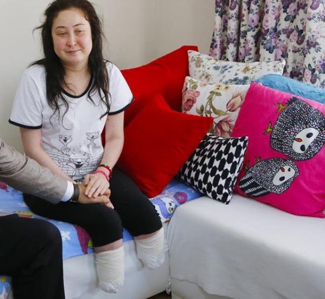 Burun əməliyyatına girdi, ayaqlarından oldu - FOTO