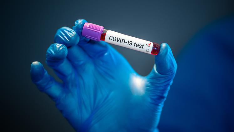 Ölkəmizdə indiyədək 2088358 koronavirus testi aparılıb