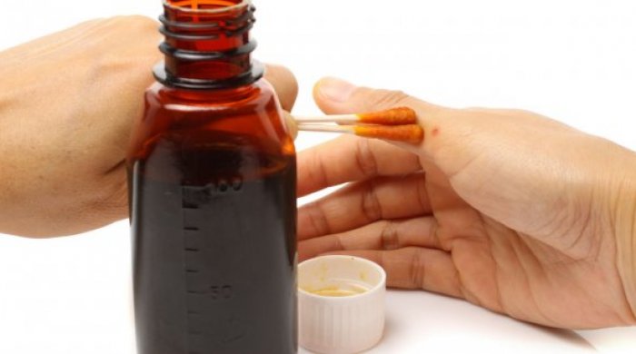 Orqanizmdə yod çatışmazlığını bildirən 9 əlamət