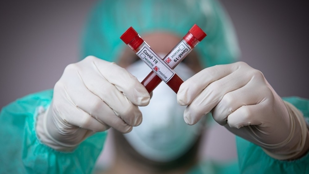Çində 111 koronavirus xəstəsinin vəziyyəti ağırdır