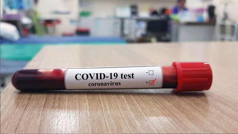 ÜST-dən koronavirusun yeni mutasiyaları ilə bağlı HESABAT 