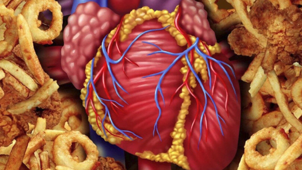 Ürək üçün ən zərərli qidalar