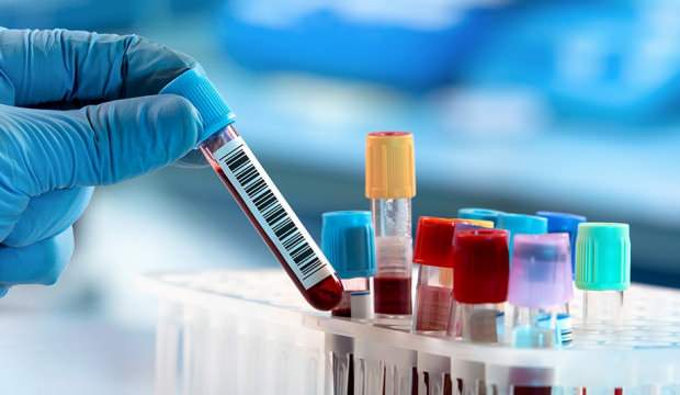 Apteklərdə satılan sürətli COVID-19 testlərinə inanmaq olarmı? - Həkim-reanimatoloq