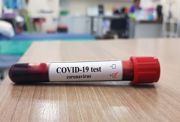 COVID-19 analiz nəticəsini onlayn qaydada əldə etmək mümkün olacaq  