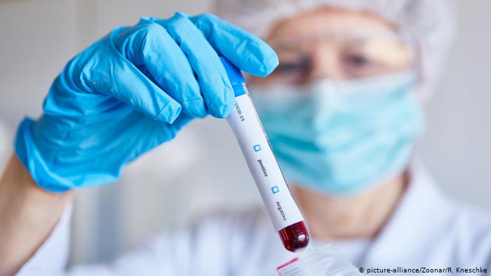 Daha bir ölkədə koronavirusun Britaniya ştammı aşkarlandı