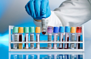 Bu ölkə virusa yoluxanların sayına görə dünya rekordu vurdu