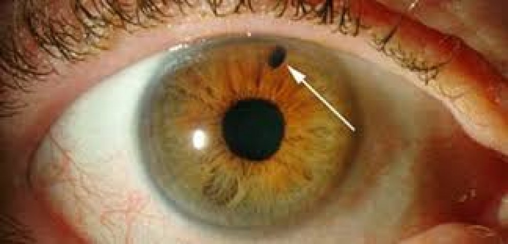 El arasında “qara su