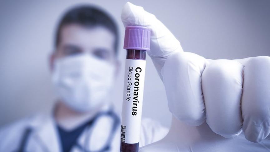 ÜST: dünyada ötən sutka koronavirusa 326 mindən çox yoluxma qeydə alınıb 