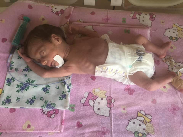 Quba Regional Perinatal Mərkəzində yenidoğulmuşlar arasında ölüm göstəricisi aşağı düşüb