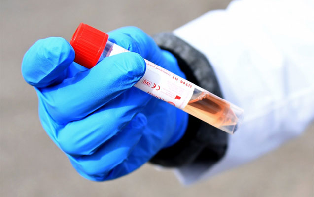 Bu ölkədə vətəndaşlar apteklərdə koronavirus testindən keçə biləcəklər