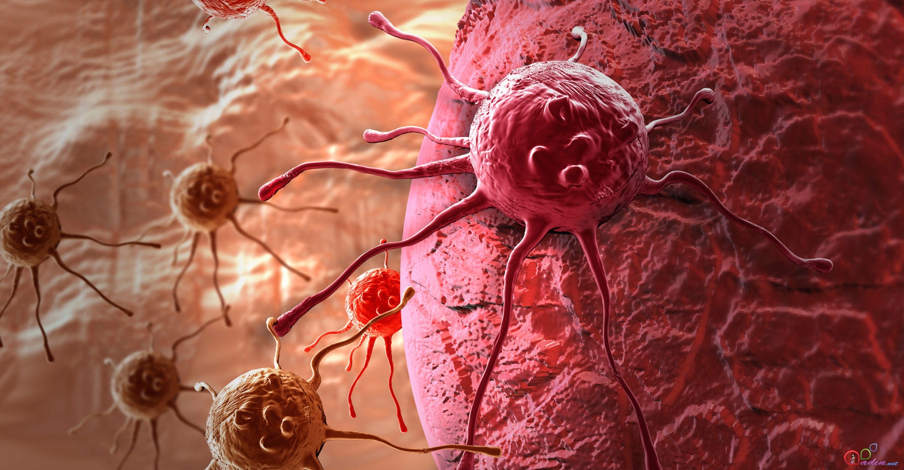 Hepatit C QARACİYƏR XƏRÇƏNGİNİN aparıcı səbəblərindən biridir
