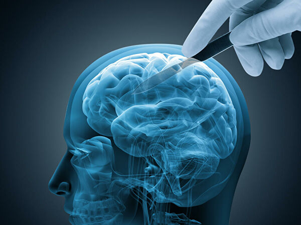 Beyin hüceyrələrini Altsheymer xəstəliyi ilə mübarizəyə yönəldən gen aşkarlanıb - YENİ KƏŞF  