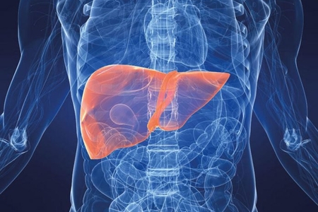 Bu xəstəlik qaraciyər sirrozu və hepatit B-nin ağırlaşmasıdır