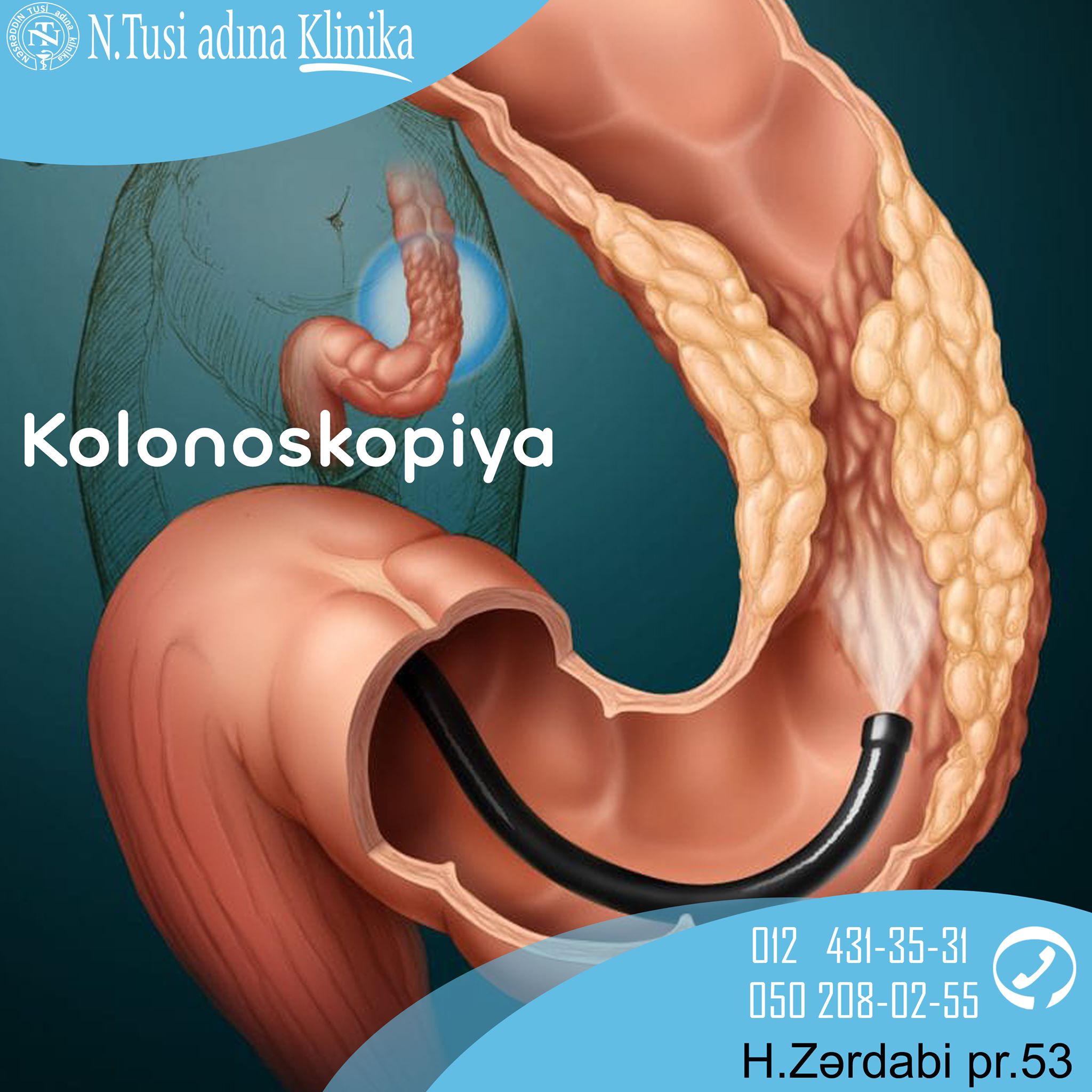 Yoğun bağırsaq xəstəliklərinin müasir müayinə üsulu - Kolonoskopiya 