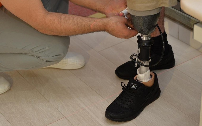 50 qazinin protezlərlə təminatı prosesi yekunlaşır