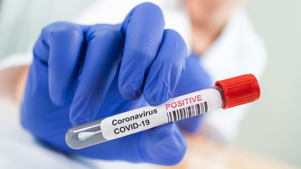 Azərbaycanda daha 48 nəfər koronavirusa yoluxdu, ölüm olmadı  
