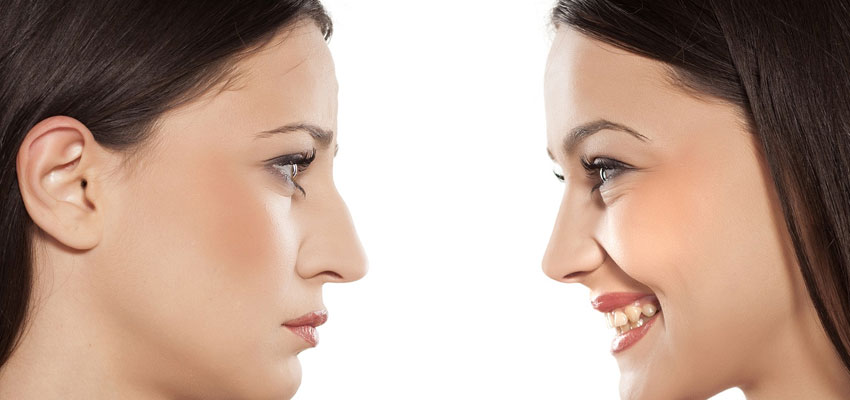 Revizion rinoplastikada önəmli nüanslar